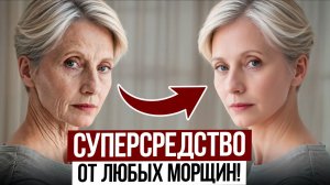 Молодость кожи начинается с ЭТОГО! / Как УБРАТЬ морщины без инъекций?