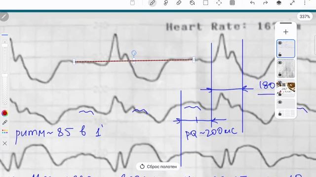 ПБ ЛНПГ и нижний ИМ