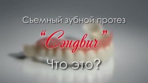 Зубной протез "СЭНДВИЧ"