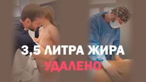 Липосакция и липофилинг ягодиц у доктора Вапии Тэйми Алиевича