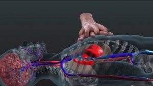 Непрямой массаж сердца в действии, 3D-модель внутри тела