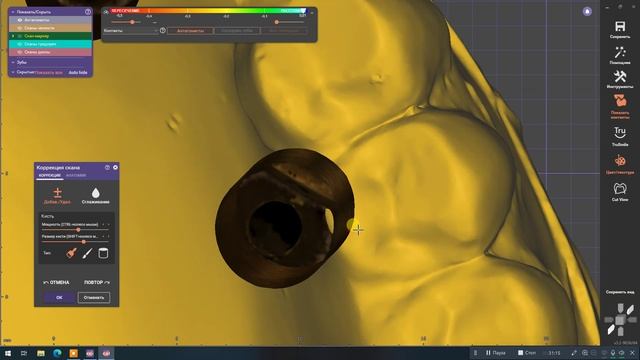 Гипсовка в ExoCad - полное руководство смотреть онлайн