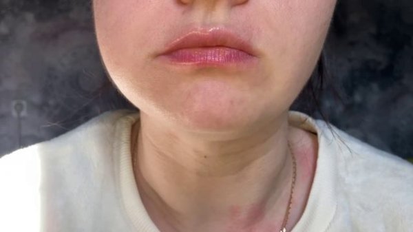 ASMR Makovka ~ Асмр Маковка