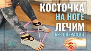 ХАЛЛЮС ВАЛЬГУС: что деформирует СТОПУ и как это ИСПРАВИТЬ в любом возрасте