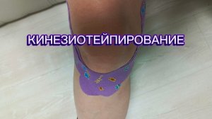 Кинезиотейпирование коленного сустава