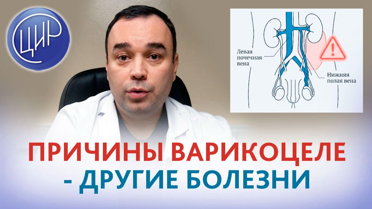 Может ли варикоцеле быть следствием других заболеваний?