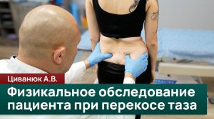 Физикальное обследование пациента при перекосе таза. Циванюк А.В.