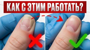 Самые ОПАСНЫЕ заболевания ногтей! / Что ОБЯЗАН знать каждый мастер?