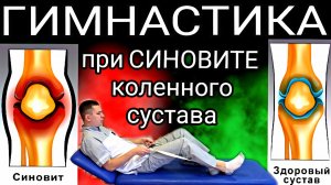 Упражнения при синовите коленного сустава / Гимнастика при воспаление синовиальной оболочки