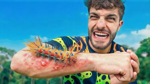 Укушен гусеницей дьяволом. Самые болючие укусы