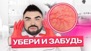 Купероз или розацеа? Как отличить и что действительно работает