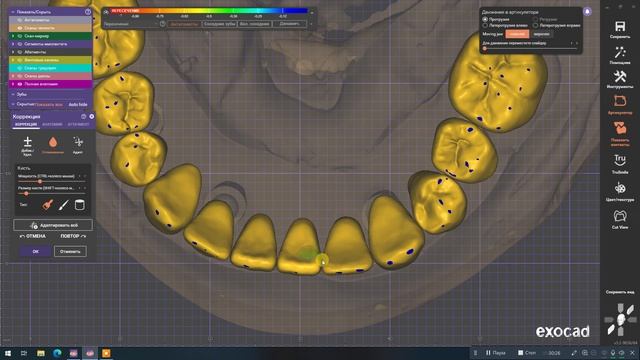 Тотал с искуственной десной на низ смотреть онлайн