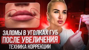 Заломы в уголках губ после увеличения
