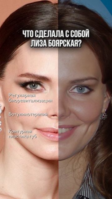 Какие процедуры у косметолога делала Елизавета Боярская? смотреть онлайн