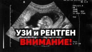 УЗИ И РЕНТГЕН.  ВНИМАНИЕ!
