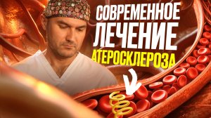 Атеросклероз сонных артерий — как лечат в 2026?