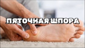 ПЯТОЧНАЯ ШПОРА