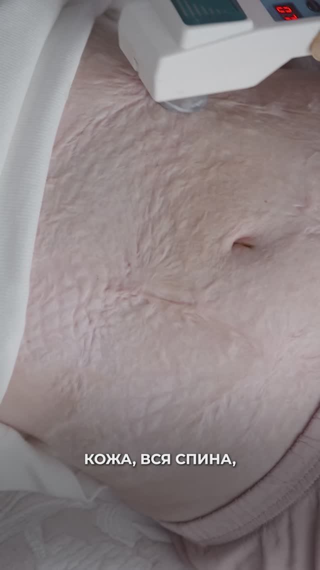 Кожа посерела и повисла лоскутами смотреть онлайн