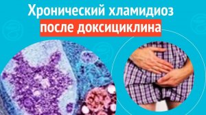 🙄 Хронический хламидиоз после доксициклина. Клинический случай № 1728