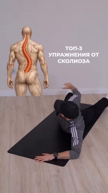 Прощаемся со сколиозом — в сети показали топ-3 упражнения, которые приведут спину и поясницу в норму смотреть онлайн