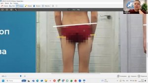 Короткая нога у детей и взрослых