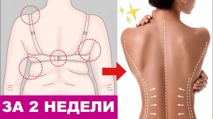 Как избавиться от валиков и складок на спине под бюстгальтером