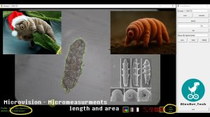 Измерение размеров и площадей микроорганизмов под микроскопом в Microvision