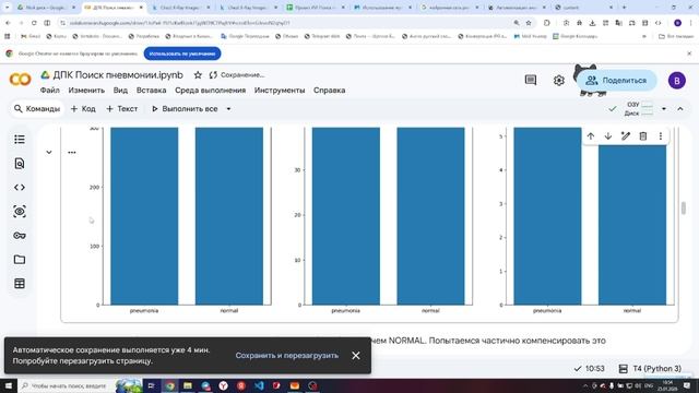 ДПК Поиск пневмонии по Rn. Часть 3 смотреть онлайн