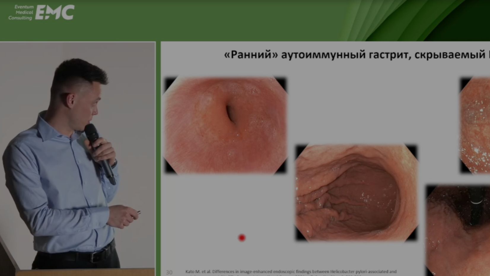 1. Щербаченя Н.А. Эндоскопические признаки аутоиммунного гастрита. Новый эндоскопический признак.