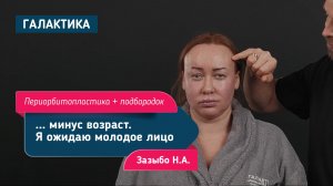 Периорбитопластика без смещения линии роста волос | Зазыбо Николай