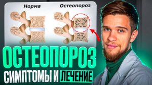 ВСЕ ПРО ОСТЕОПОРОЗ. СИМПТОМЫ И ЛЕЧЕНИЕ ОСТЕОПОРОЗА