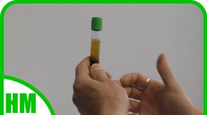 Архив. 2023г. Шикарный метод для больных суставов. Плазмотерапия. PRP-терапия. Боль уходит 🙏