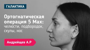 Ортогнатическая операция + омоложение взгляда | Андрейщев Андрей