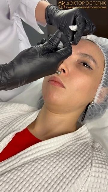 Как колют ботокс?