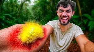 Укушен гусеницей львом. Самые болючие укусы