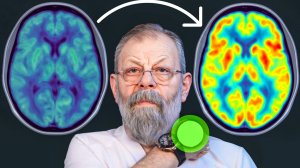 Активация мозга