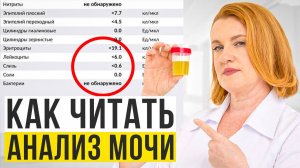 Это СПАСЁТ ВАМ ЖИЗНЬ! Как расшифровать АНАЛИЗ МОЧИ?
