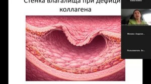 Роль коллагена в вопросах женского здоровья.  Марина Майер