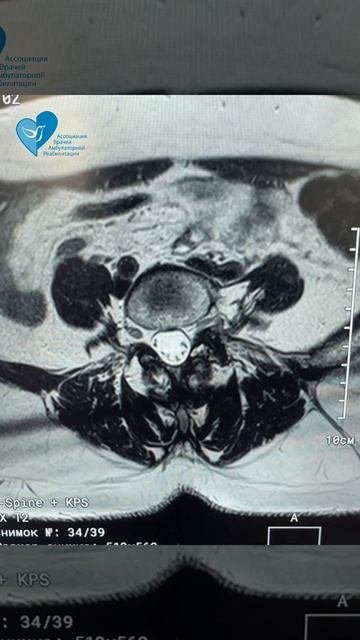 Боль в спине смотреть онлайн