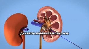 Самый эффективный метод удаления больших и коралловидных камней почек