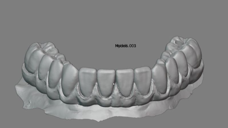 Моделирование балки в B4D на имплантах (Обновленный гайд) смотреть онлайн