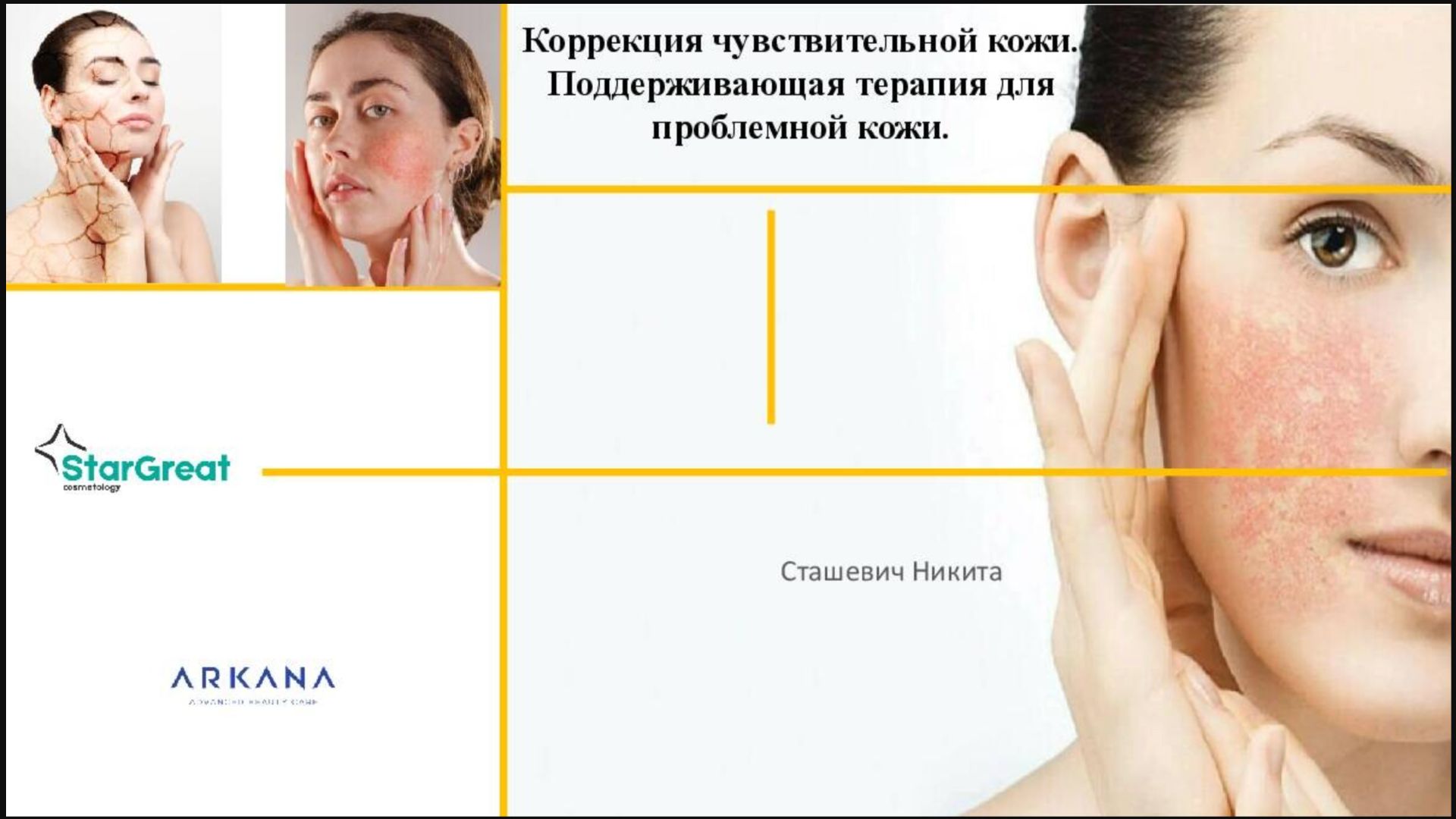 Чувствительная кожа смотреть онлайн