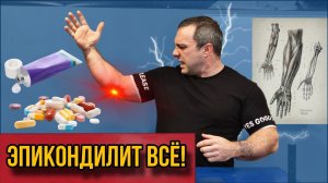 Реабилитация эпикондилита