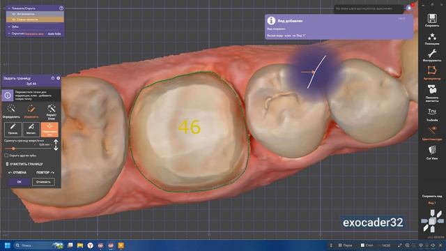 ExoCad - моделировка 46 с интроорального скана смотреть онлайн