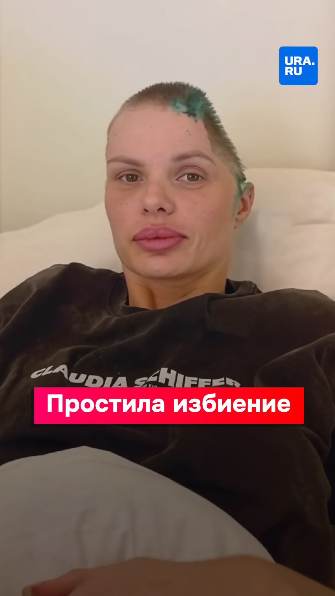 Модель, которой удалили половину черепа, простила обидчика смотреть онлайн