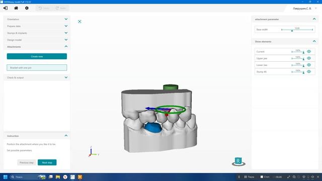Shera - создание модели с интролорального скана смотреть онлайн