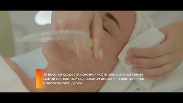 Газожидкостый пилинг или безинъекционная биоревитализация смотреть онлайн