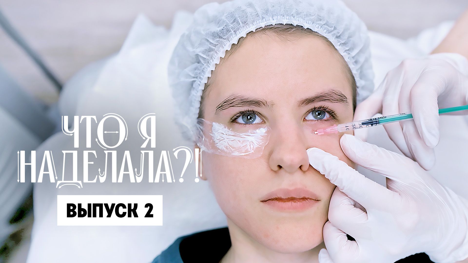 Что я наделала?! Коллаген: красота или слезы? смотреть онлайн