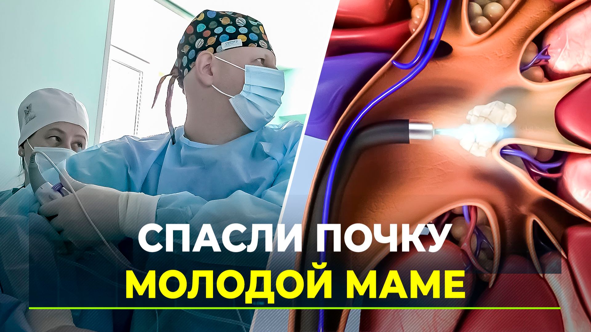 Комбинированную урологическую операцию провели на Ямале смотреть онлайн