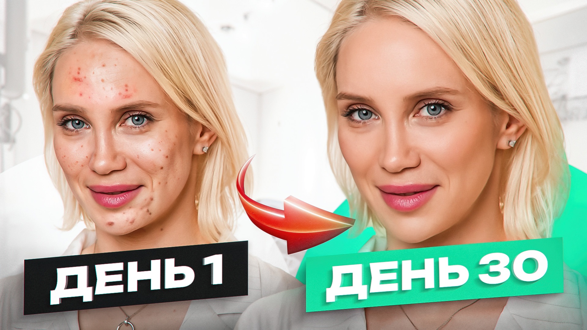 У кожи есть иммунитет. 5 шагов, чтобы его ПОВЫСИТЬ до максимума смотреть онлайн